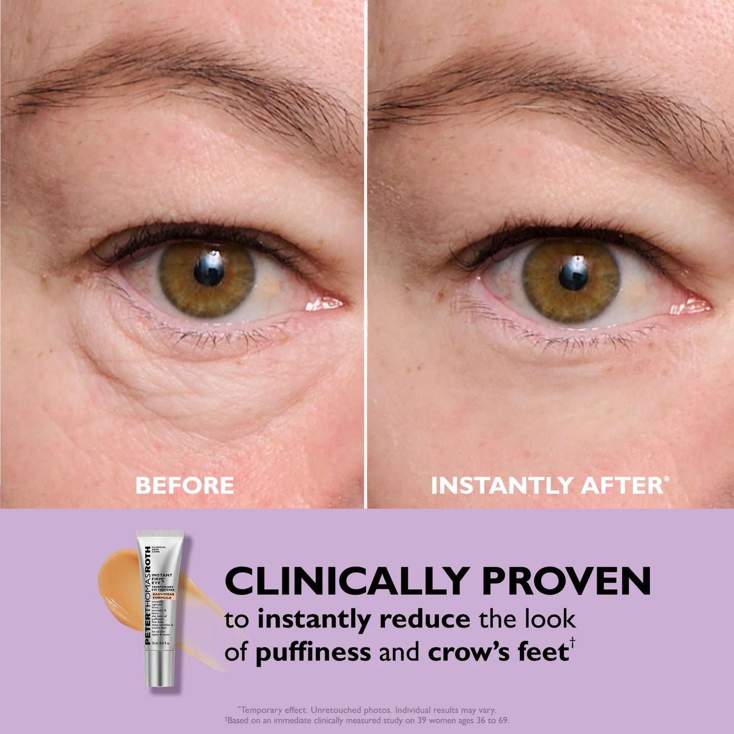Instant Eye Tightener