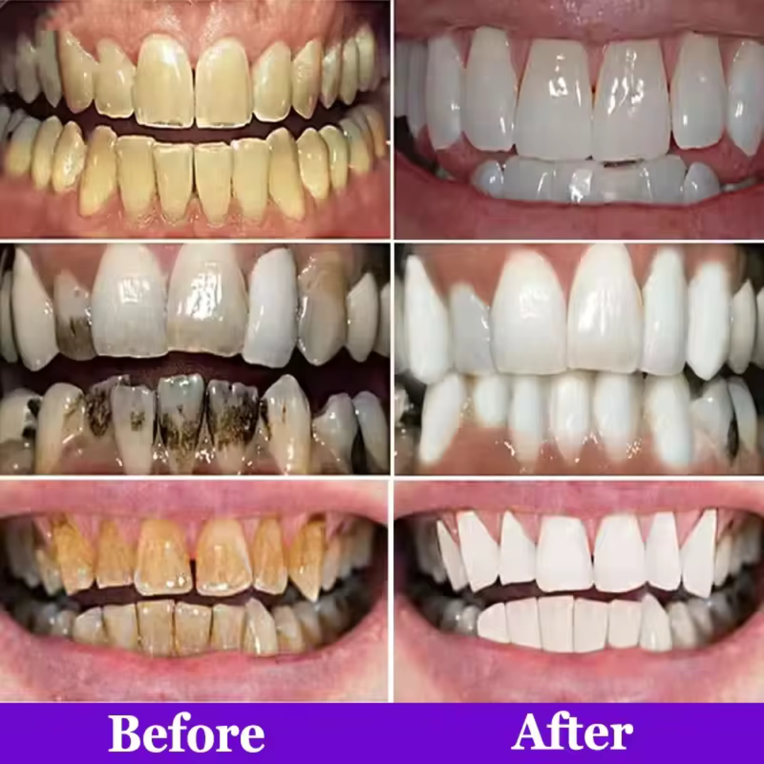 Purple Teeth Whitening Strips