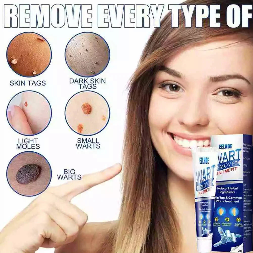 WartAway Herbal Creams Remover