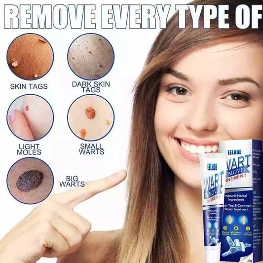 WartAway Herbal Creams Remover